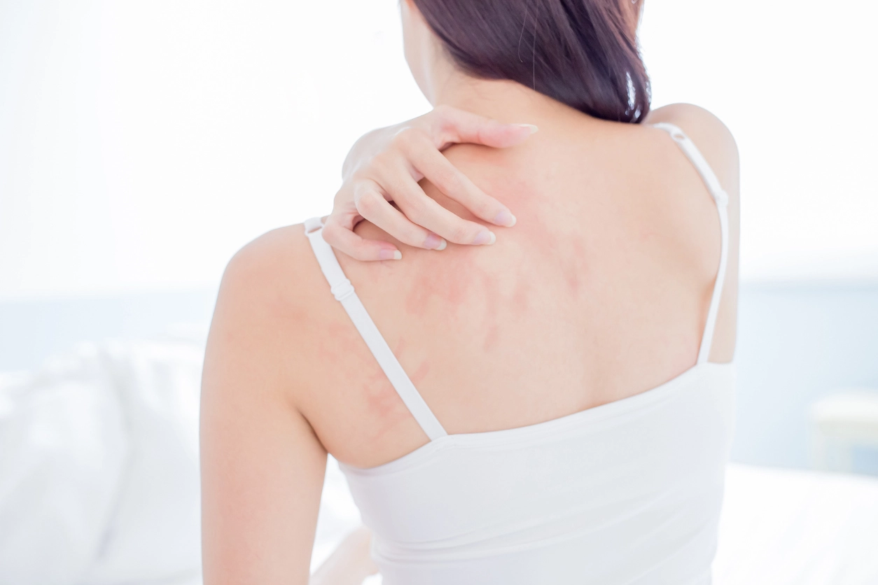 Am I Allergic to Alcohol?