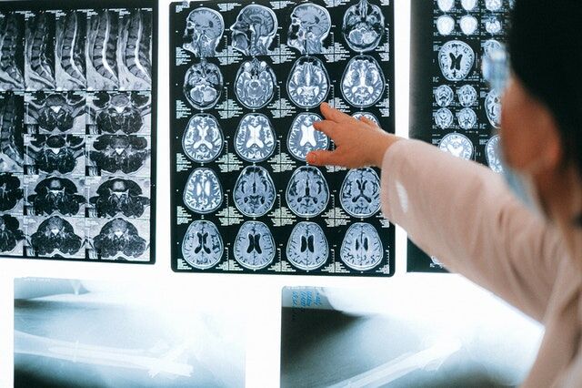 How does addiction affect the body and brain?